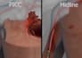 create 3d cardiovascular medical device animation and medical explainer video